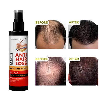 Anti Hair Loss Spray Dr. Sante